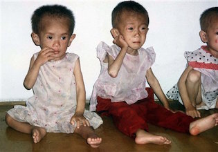 FILE - In this July 12, 1997, file photo, children between the ages of 4 and 5, suffering from malnutrition are pictured in a nursery in Anpyon County, Kangwon province in hunger-stricken North Korea. Saving the lives of North Koreans in danger of starving should have nothing to do with international politics, a U.S. official told lawmakers in March 2011. Food aid is a purely humanitarian matter. But 11 weeks later, the Obama administration is only now taking the first steps toward providing aid, the process slowed not just by distrust of North Korea but the risk of alienating South Korea, a staunch U.S. ally. North Korea suffered a 1990s famine that saw about a million of its 23 million people starve, as natural disasters and decades-long mismanagement devastated its centrally controlled economy. (AP Photo/Kathy Zellweger, Pool)